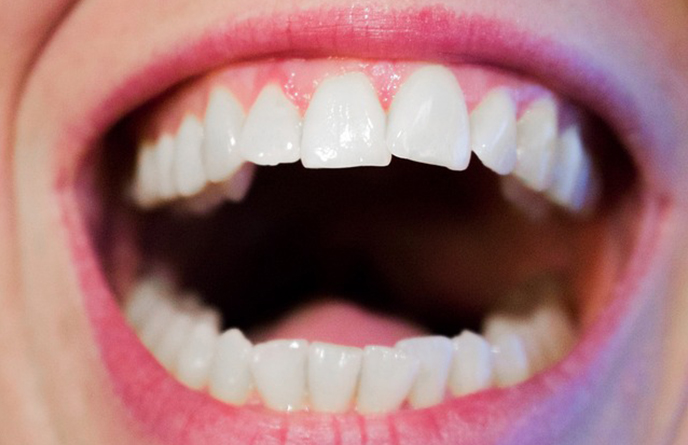 Restorative-Treatment-and-Endodontics